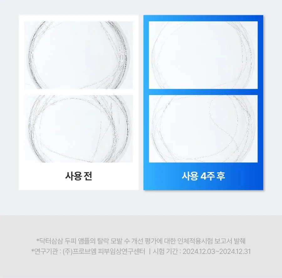 [탈모증상완화] 씨퓨리 닥터33 탈모앰플 20ml NEW 상세페이지 29